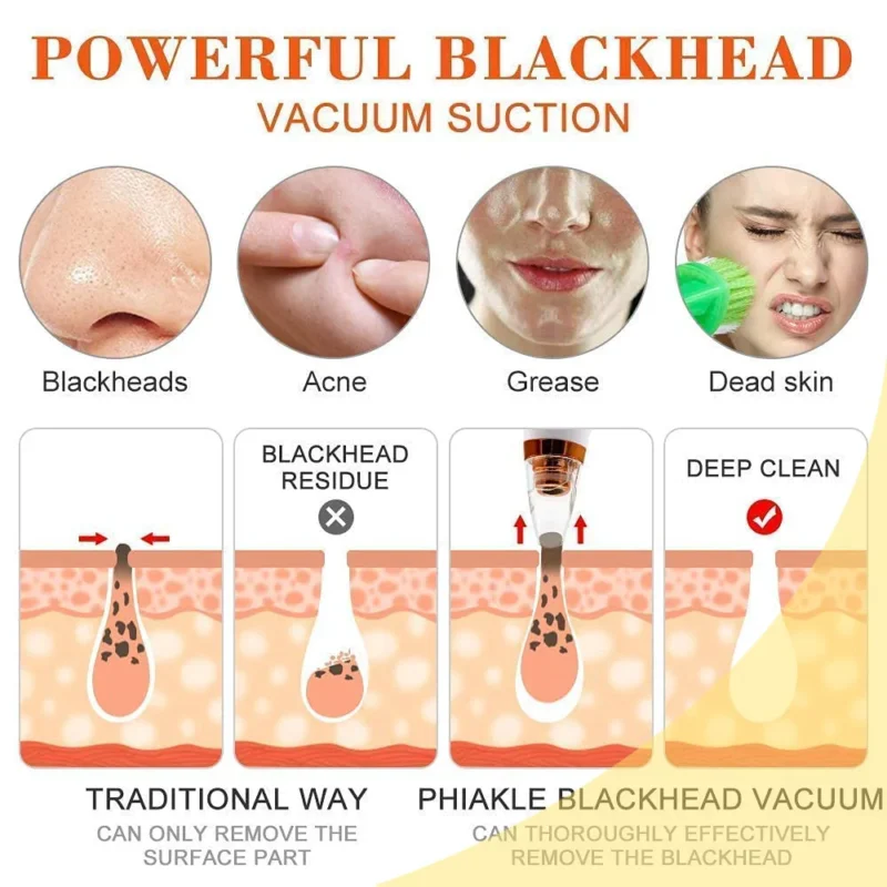 6 in 1 Multi-function Blackhead Remover Tools - Image 5