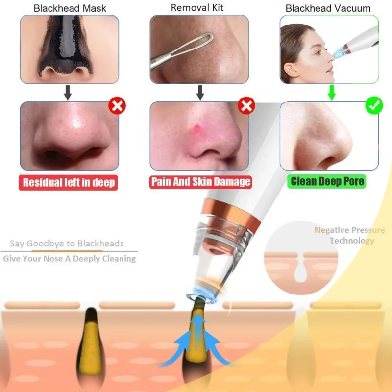 6 in 1 Multi-function Blackhead Remover Tools - Image 10