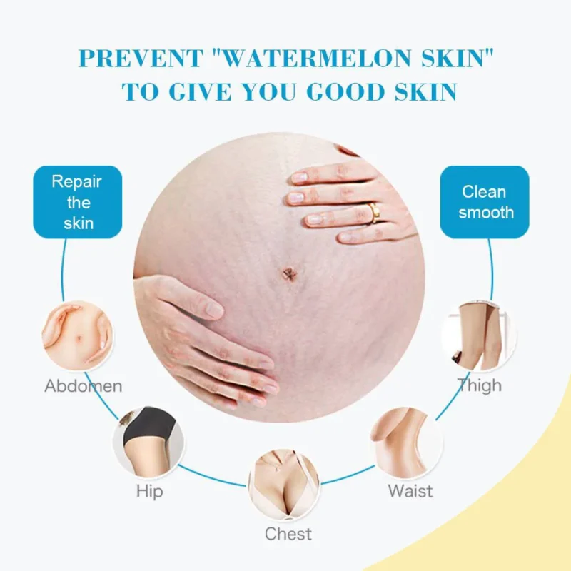 AICHUN BEAUTY Anti Stretch Mark Cream - Image 12
