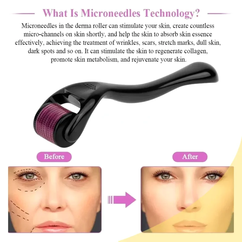Derma Roller System - Image 2