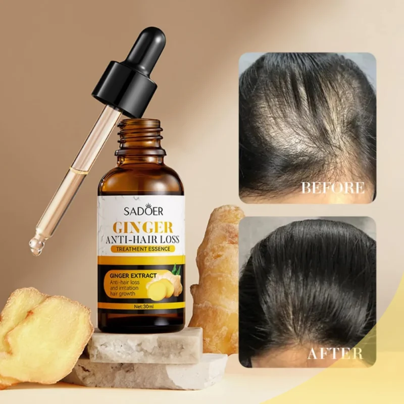 SADOER Ginger Anti-Hair Loss - Image 5